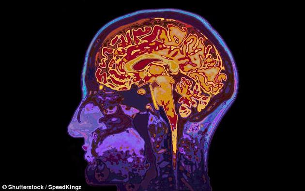 研究人員著重觀察了三個腦區(qū)：背內側前額葉皮質、尾狀核、以及丘腦。