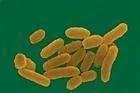在病灶標(biāo)本中 圖2。鼠疫桿菌Yersing pestis（圖片來源：搜狗百科[2]）
